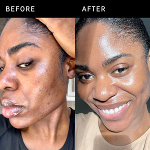 Before and after of an INKEY customer using Omega Water Cream