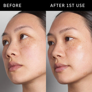 Model's skin before and after using Hyaluronic Acid Serum once