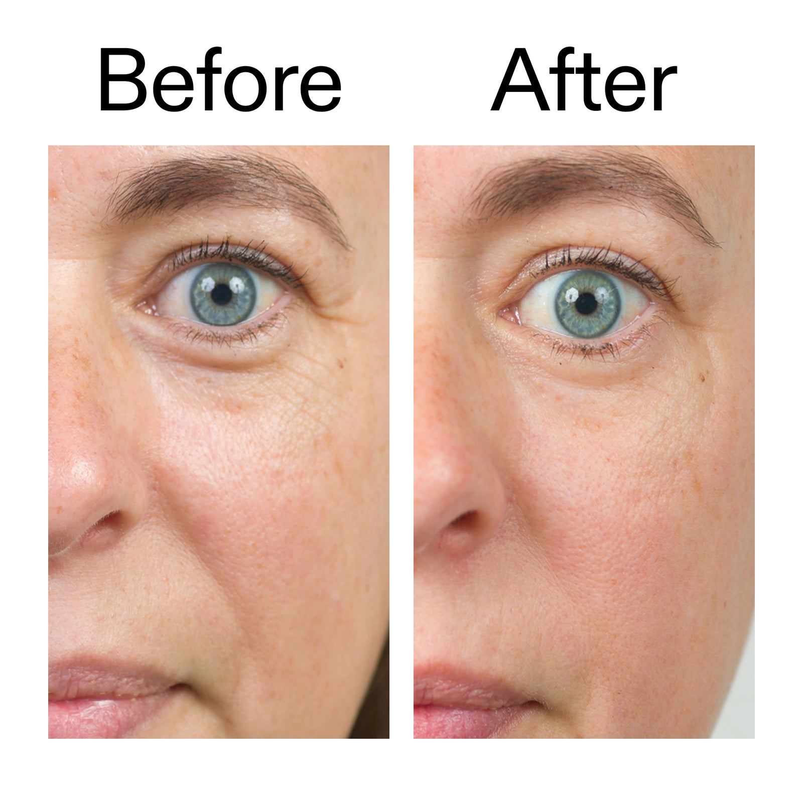 Before and after of customer using BioActive Moisturiser