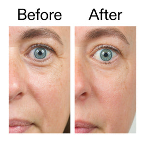 Before and after of customer using BioActive Moisturiser