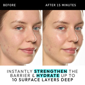 Instantly strengthens the barrier and hydrated up to 10 surface layers deep