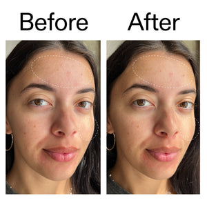 Before and after comparison of a woman's face with visible improvements using Glyercin Cleanser
