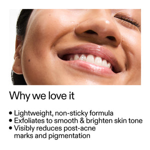 Close-up of a smiling person's face with text about Mandelic Acid Treatment benefits.