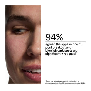 Close-up of a person's face with text about dark spot reduction after using Mandelic Acid Treatment, on a white background.