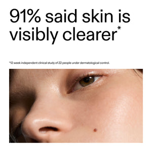 Close-up of a person's eye with text indicating skin clarity improvement after using Acne Clearing Moisturizer with 2% Novoretin