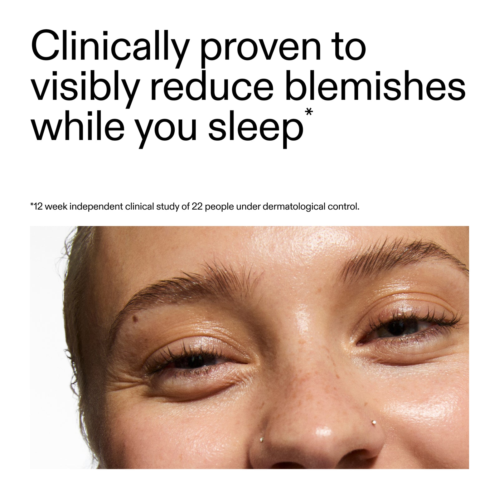 Advertisement for Acne Clearing Moisturizer with 2% Novoretin showing a close-up of a person's eye with text claiming clinical provenance.