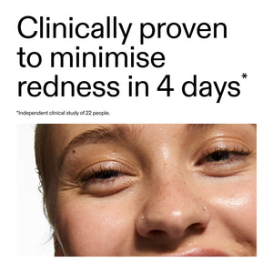 Close-up of a person's eye with text claiming clinical provenance if Azelaic Acid Serum helping to minimize redness in 4 days.