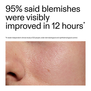 Advertisement showing a close-up of skin with blemishes and text about improvement in 12 hours after using Succinic Acid Acne Treatment