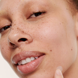 Model with Hydrocolloid Invisible Pimple Patches on skin