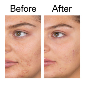 Supersize Salicylic Acid Cleanser Duo