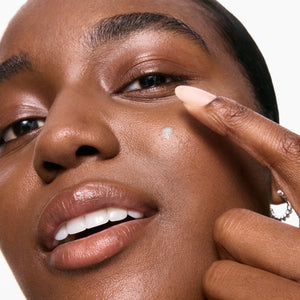 Model applying Succinic Acid Acne Treatment to her face