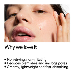 Close-up of a person's face with text highlighting Succinic Acid Acne Treatment benefits