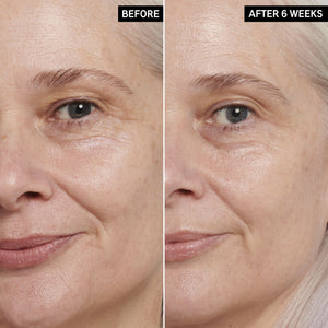Two images of a mature female model's face side by side to show before and after using Retinol Eye Cream
