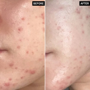 Before and After of customer using Succinic Acid Treatment
