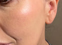 Best Sunscreen for Dry Skin: Ingredients to Look For