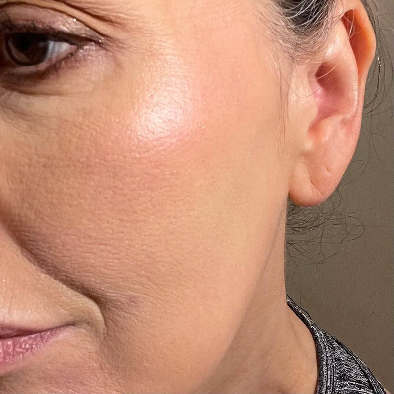 Woman with dry skin