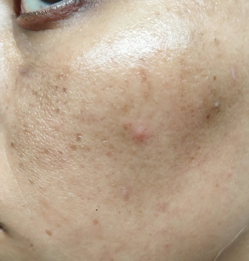 close up of face