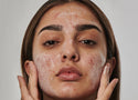 Benzoyl Peroxide : What you need to know