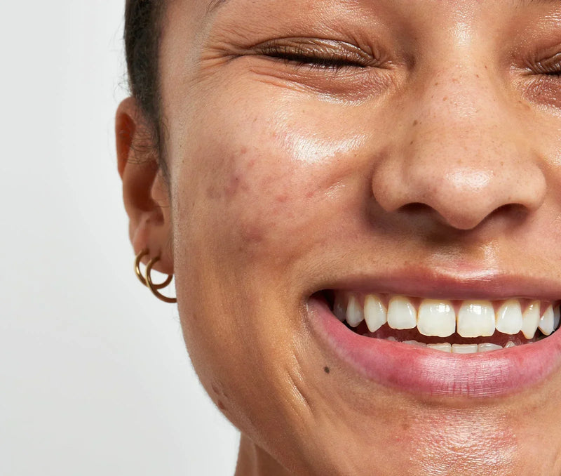 woman smiling with her eye shut