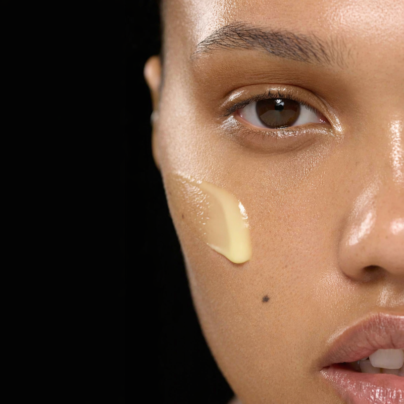 woman with exoosme on her face