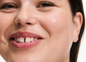 Is Niacinamide Good for Dry Skin?