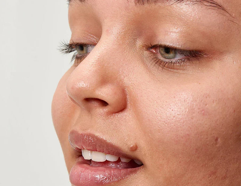 Woman with a mole on her face