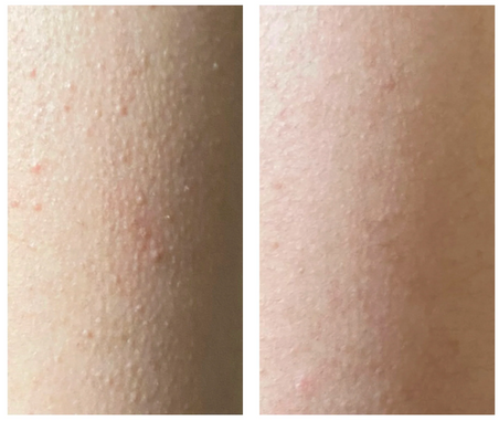 Seasonal Moisturizer Adjustments by Climate Zone: Complete Guide Seasonal Moisturizer Adjustments by Climate Zone: Complete Guide