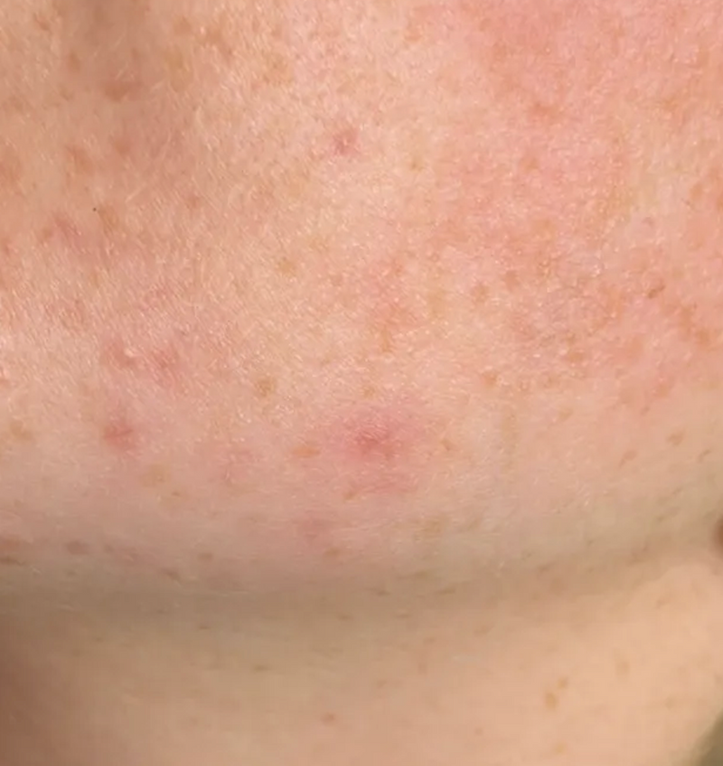 Close up on red skin
