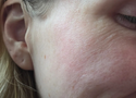 Natural Retinol Alternatives: What Actually Works?
