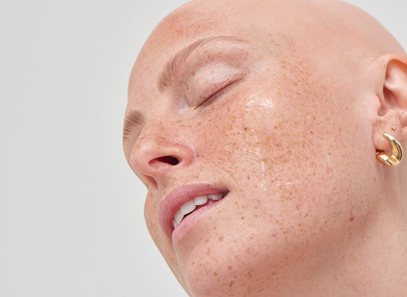 Model with collagen on her face