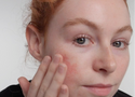 Can You Use Retinol with Rosacea-Prone Skin?