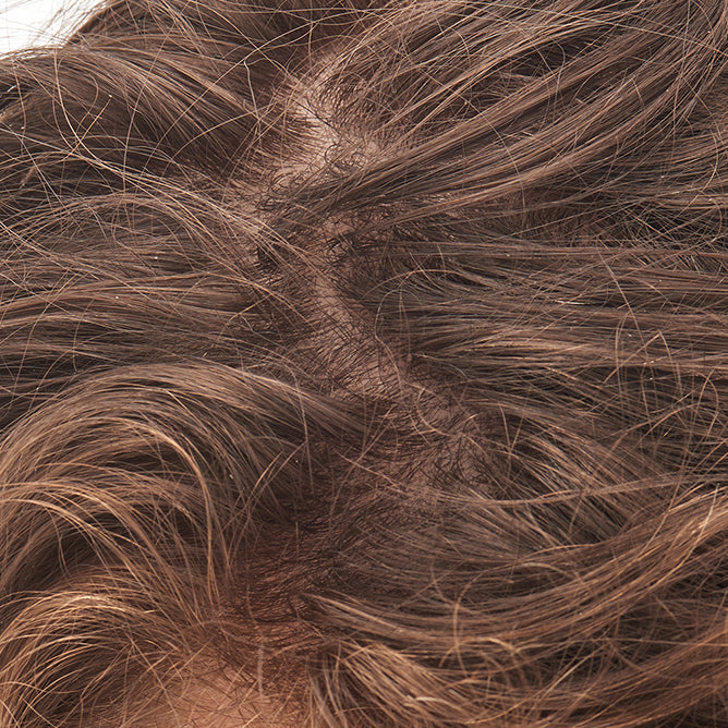 close up of scalp