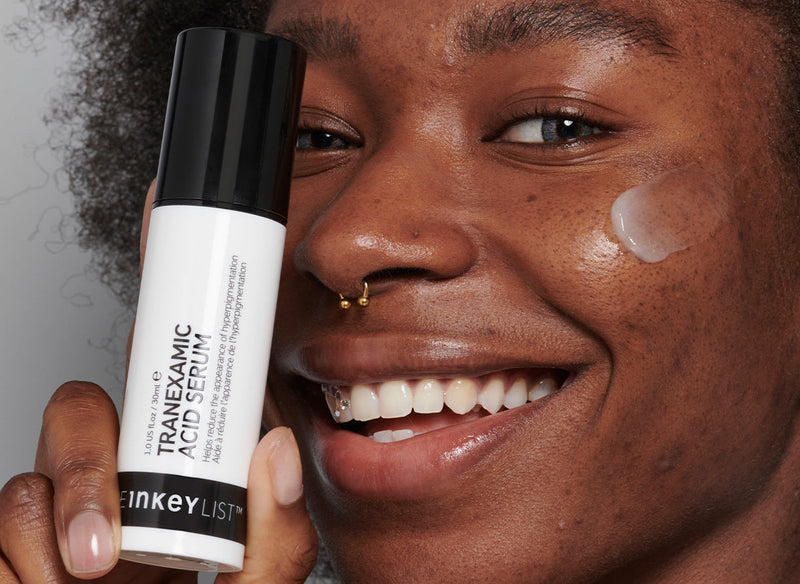 What type of skin hyperpigmentation do I have? model shot blog cover