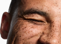 Does Sunscreen Really Help with Hyperpigmentation? Here Is What the Science Says
