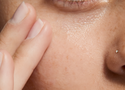 How to Get Rid of Dark Spots on Face: Causes, Types & Treatments