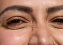 Dehydration Lines vs Wrinkles: How to Tell Them Apart and What Actually Works