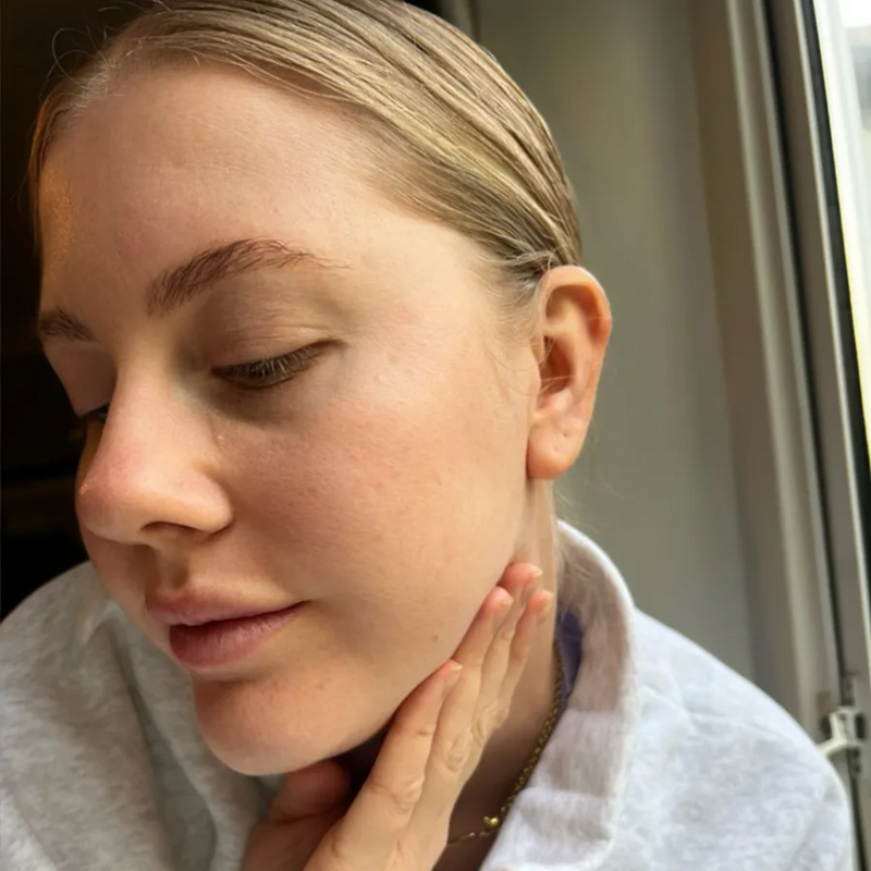 woman with dry skin