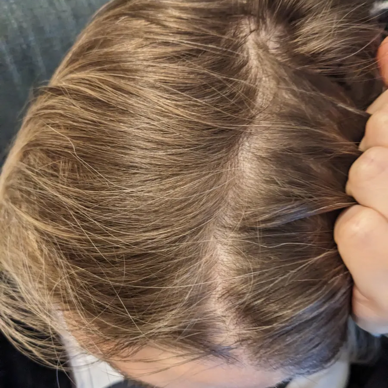 close up of scalp