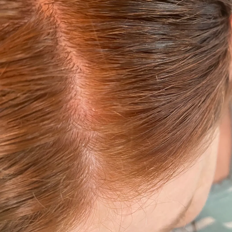 close up of oily scalp
