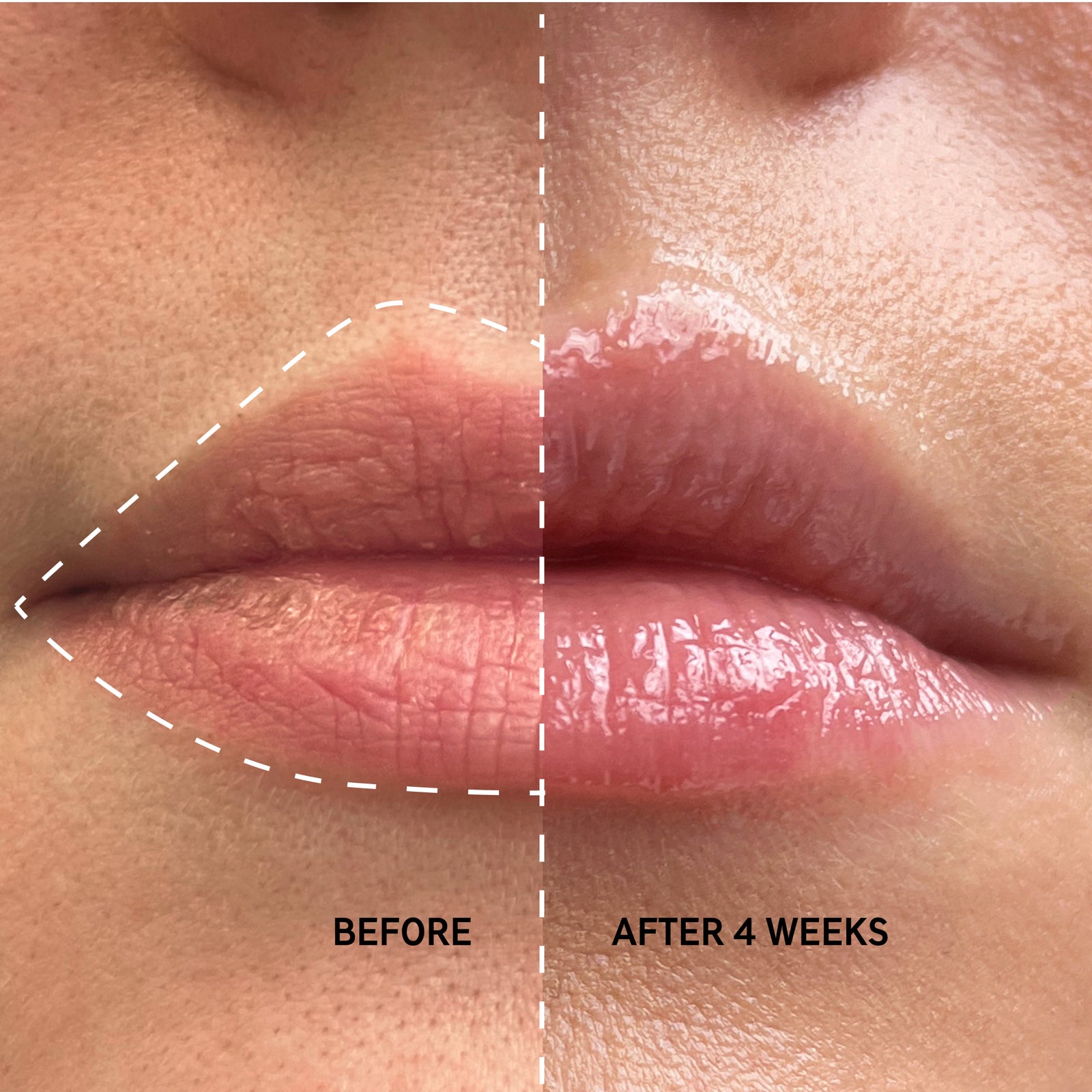 Before and after using Tripeptide Plumping Lip Balm for 4 weeks