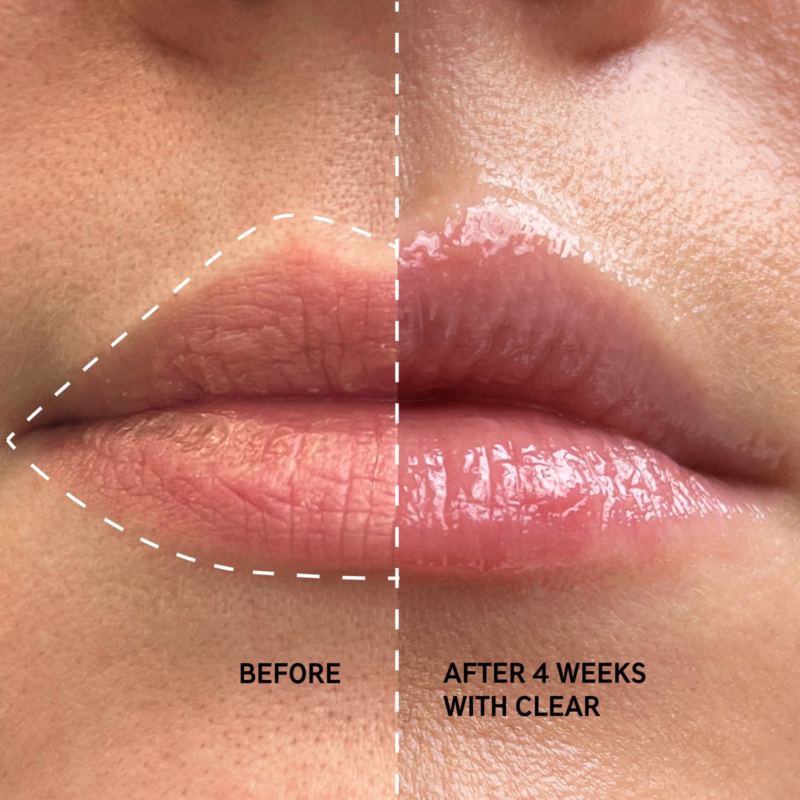 Key claim: Plumps lips up to 40% in 4 weeks* *4 week independent clinical study of 20 people