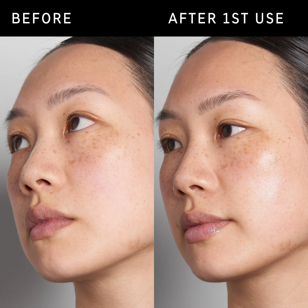 Model's skin before and after using Hyaluronic Acid Serum