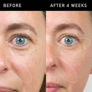 Before and after images to show Bio-Active Ceramide Repairing and Plumping Moisturizer results after 4 weeks