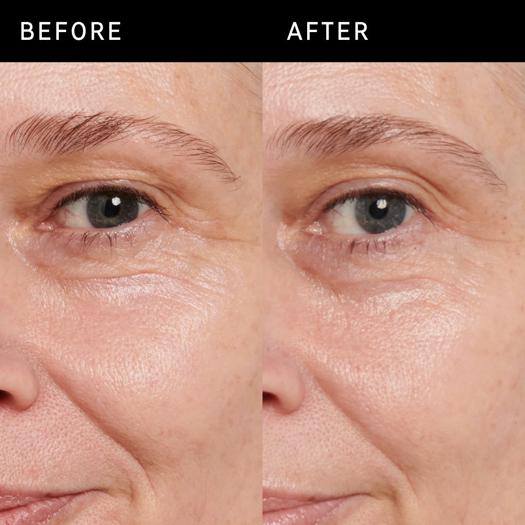 Retinol Eye Cream The INKEY List USA retinol-eye-cream-the-inkey-list-usa