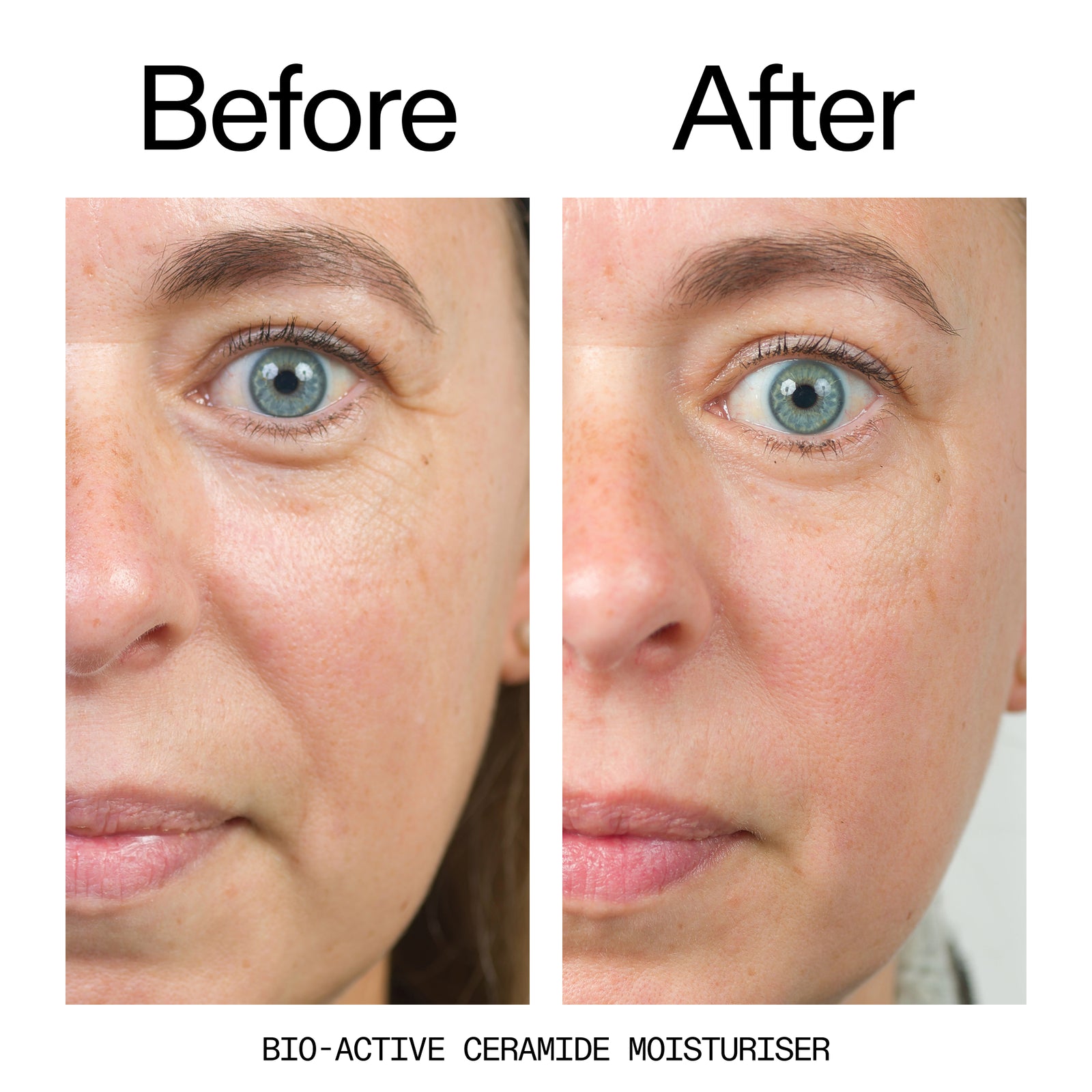 before and after of customer using Bio-Active Moisturizer