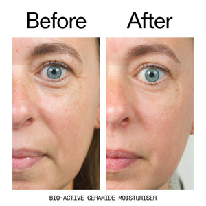 before and after of customer using Bio-Active Moisturizer