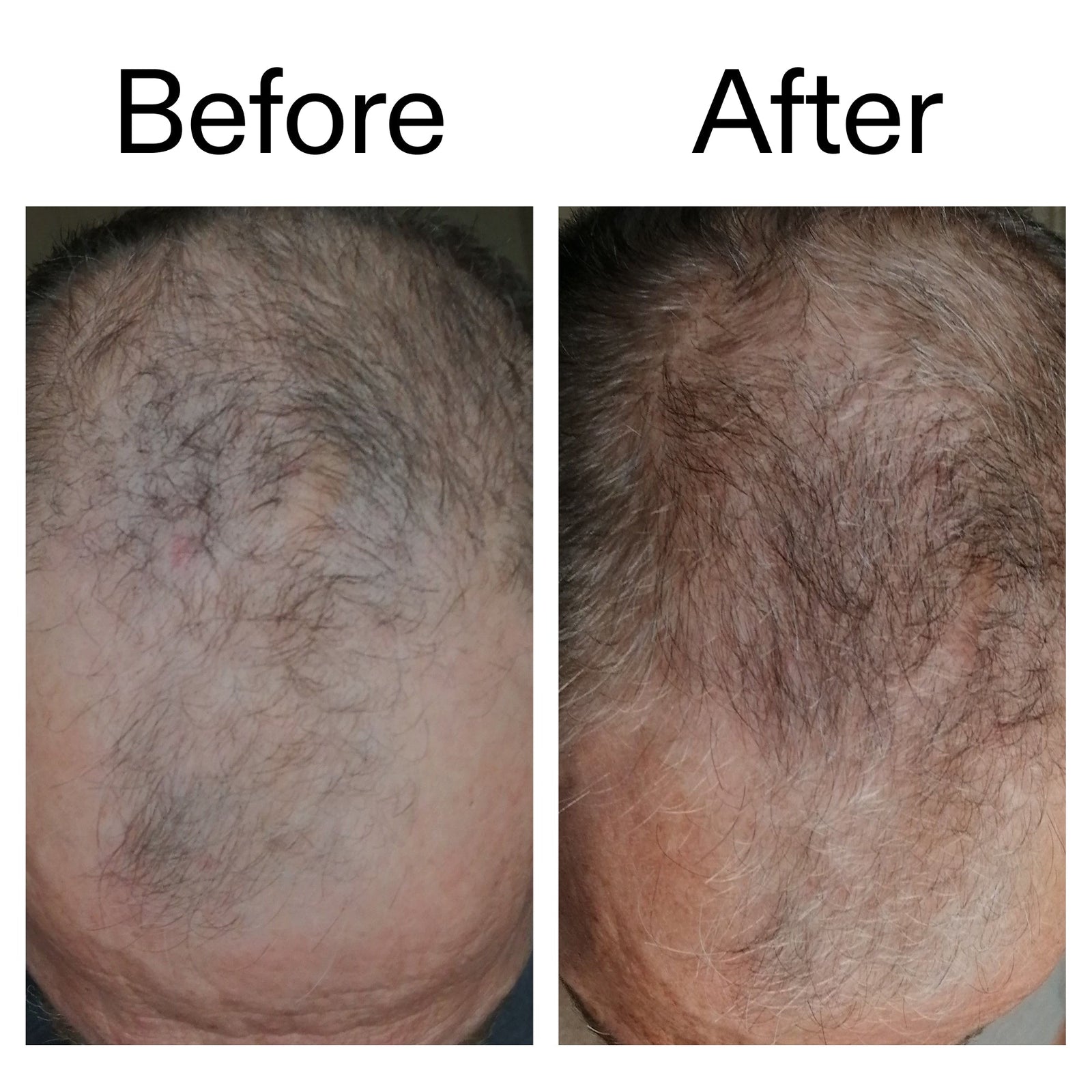 Caffeine stimulating scalp treatment Caffeine stimulating scalp treatment
