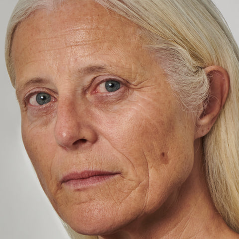 Model with deep wrinkles and discolouration