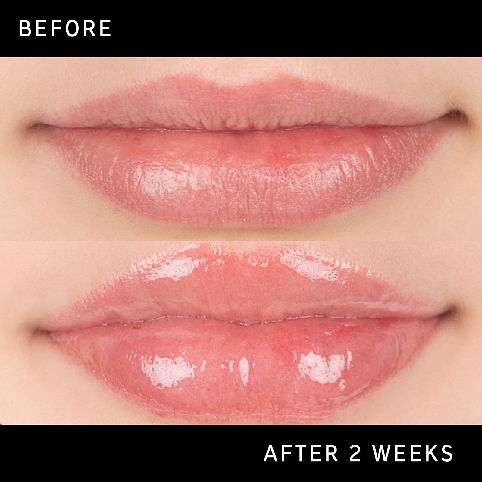 glutathione lip balm before and after results Lightening Cream Plus allantoin and ceramides support the skin barrier for refreshed Best Volumizing Lip Plumper -