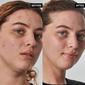 Before and after of using Dry and Rough Skin Solution